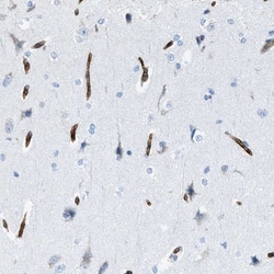 SLC22A15 Antibody, Novus Biologicals:Antibodies:Primary Antibodies